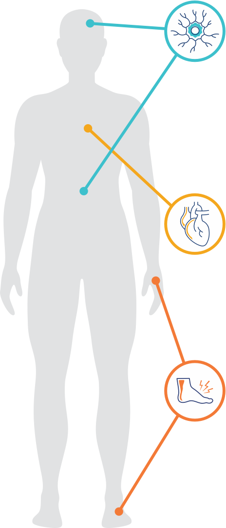 Áreas de síntomas de amiloidosis AhTTR: sistema nervioso periférico, sistema cardiaco, sistema nervioso autónomo